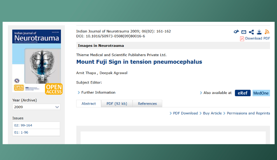 Mount Fuji Sign in Tension Pneumocephalus